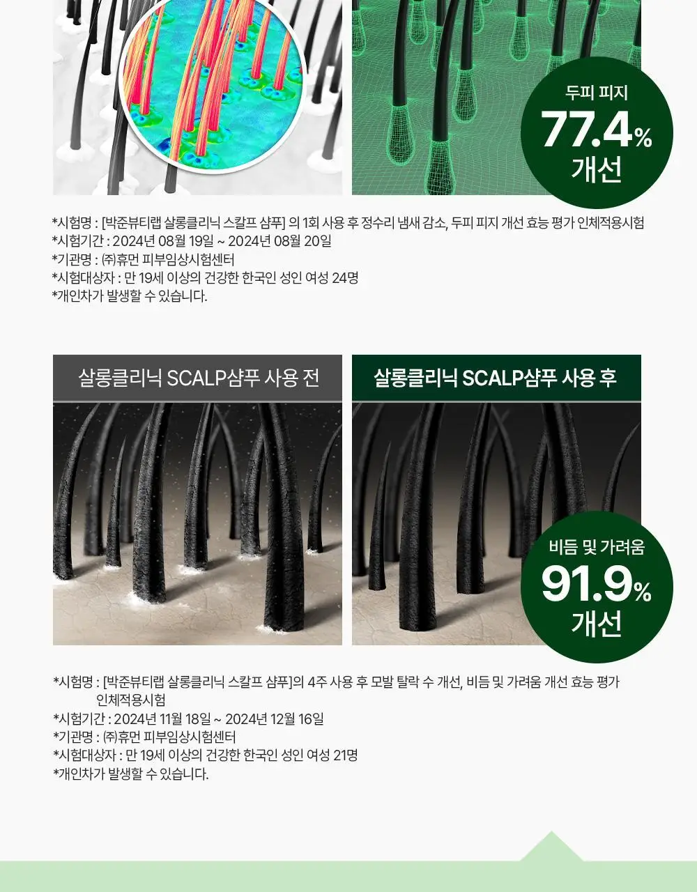 [각질/가려움] 박준뷰티랩 두피 클리닉 정수리 샴푸 500+200ml 두피샴푸 증정기획 상세페이지 15